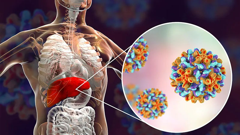 Gejala Hepatitis B yang Perlu Diwaspadai dan Cara Penularannya – PAFI Sungai Liat